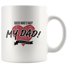 Load image into Gallery viewer, Guess Who's Rad? White Accent Mug