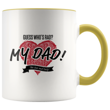 Load image into Gallery viewer, Guess Who's Rad? White Accent Mug
